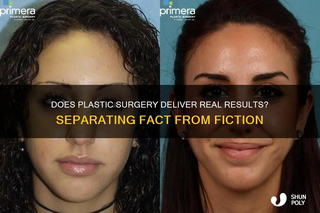 does plastic surgery ever work