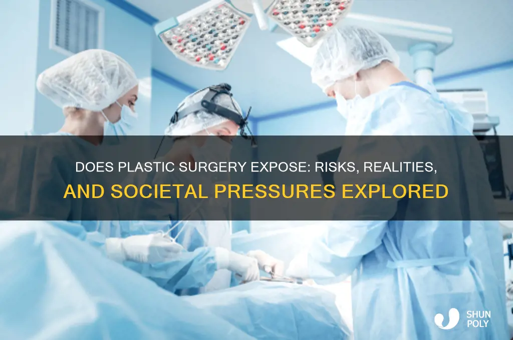 does plastic surgery expore