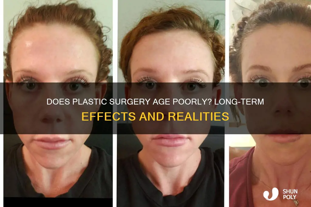 does plastic surgery get bad after a few years