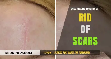 Can Plastic Surgery Effectively Remove Scars? Exploring the Possibilities