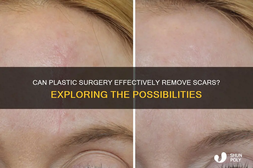 does plastic surgery get rid of scars