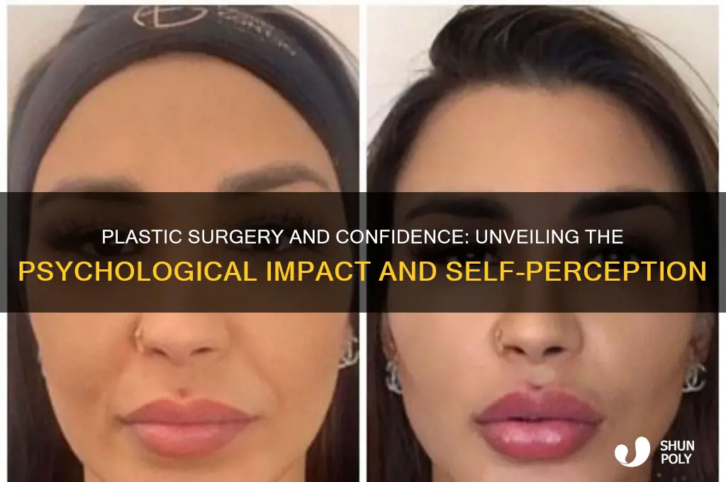 does plastic surgery give you confidence