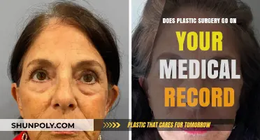 Does Plastic Surgery Appear on Your Medical Record? Facts Revealed