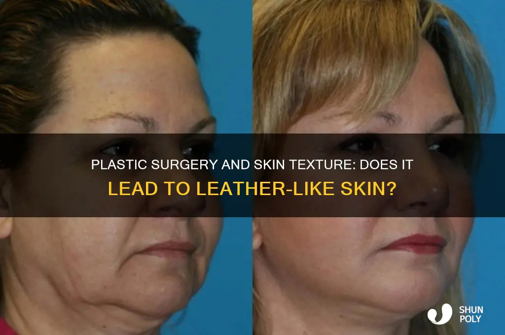 does plastic surgery make skin like leather