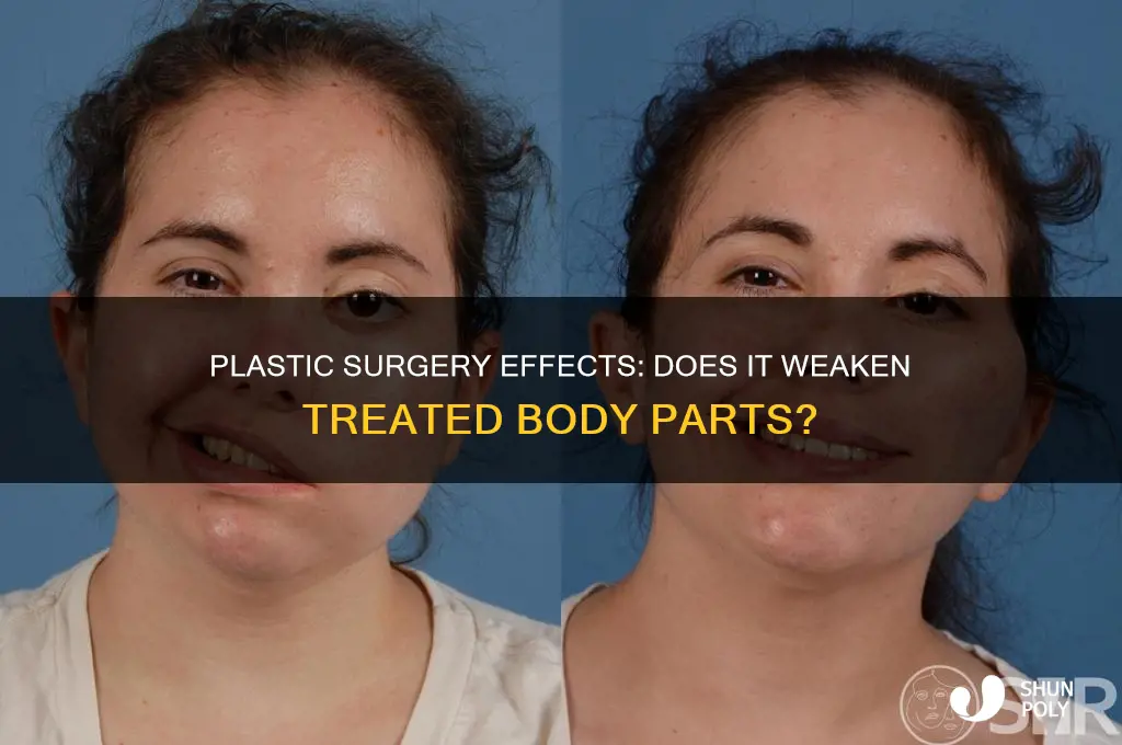 does plastic surgery make that body part weaker