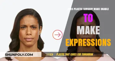 Plastic Surgery and Facial Expressions: Myth or Reality?
