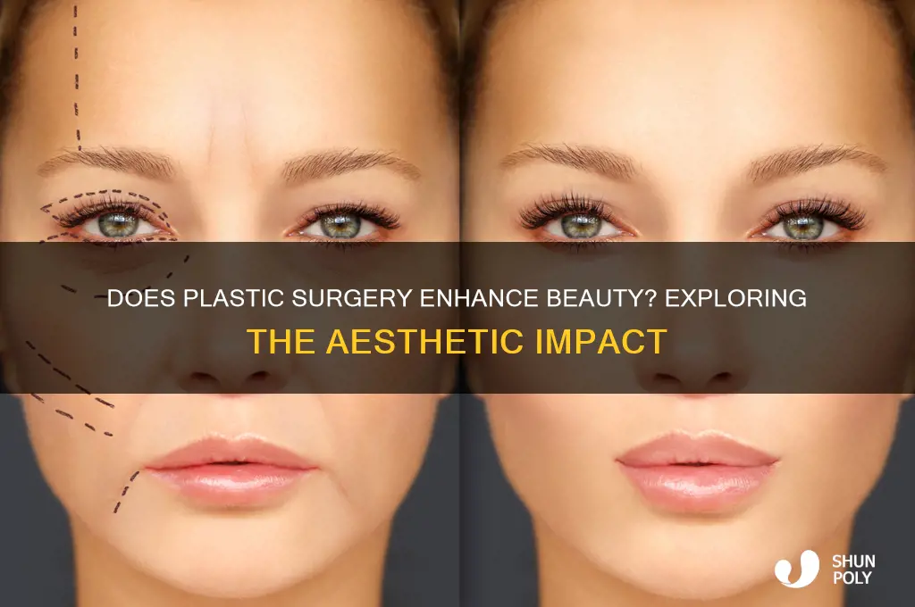 does plastic surgery make you better looking