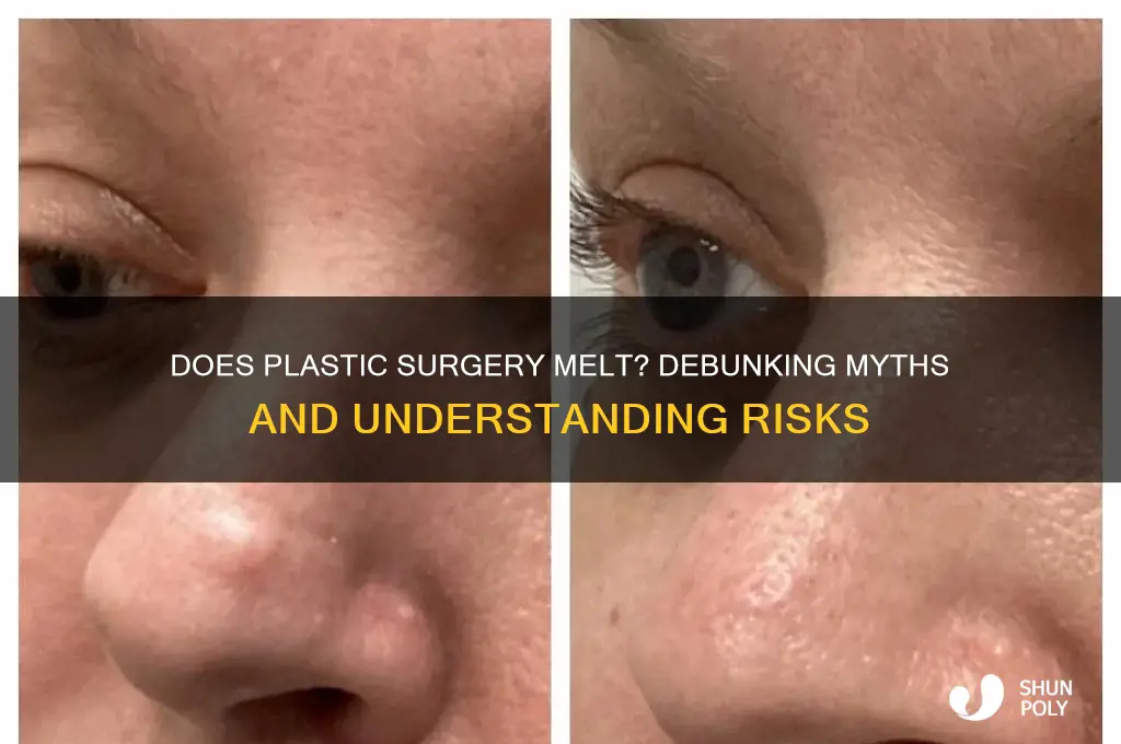 does plastic surgery melt
