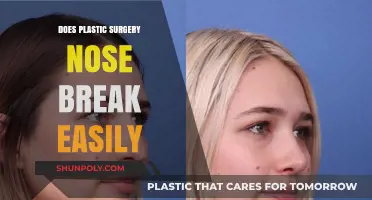 Does a Plastic Surgery Nose Break Easily? Facts and Myths Explained