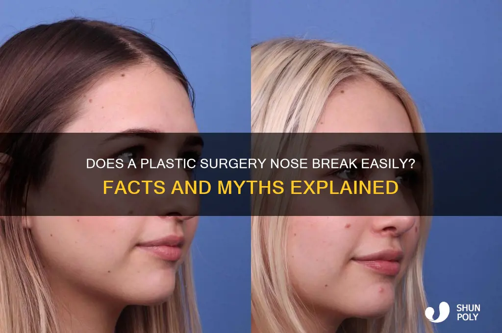 does plastic surgery nose break easily