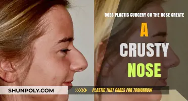 Does Rhinoplasty Lead to a Crusty Nose? Facts and Myths