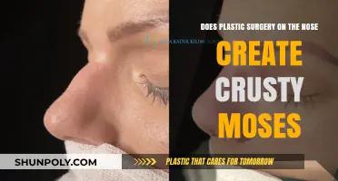 Nose Jobs and Crusty Moses: Unraveling the Plastic Surgery Myth