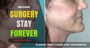 Does Plastic Surgery Last Forever? Longevity and Maintenance Explained