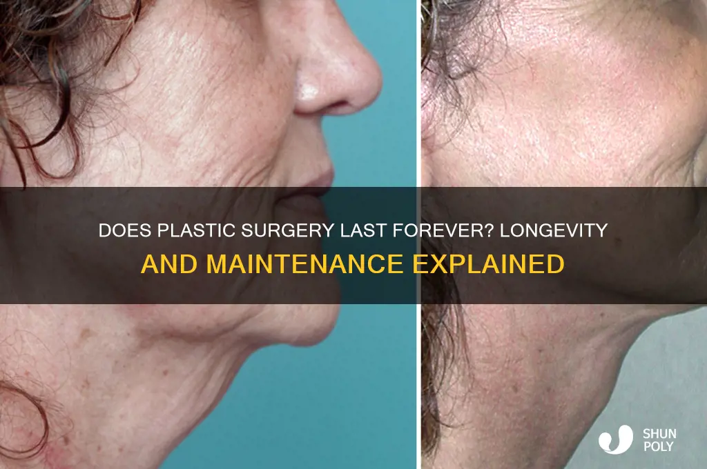 does plastic surgery stay forever