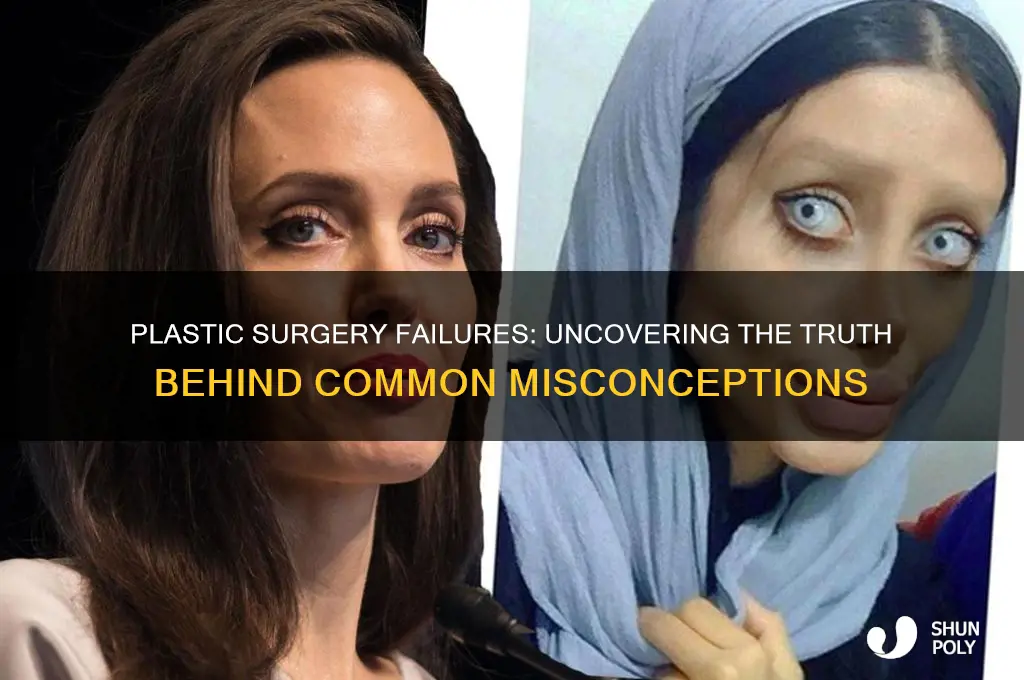 does plastic surgery usually fail