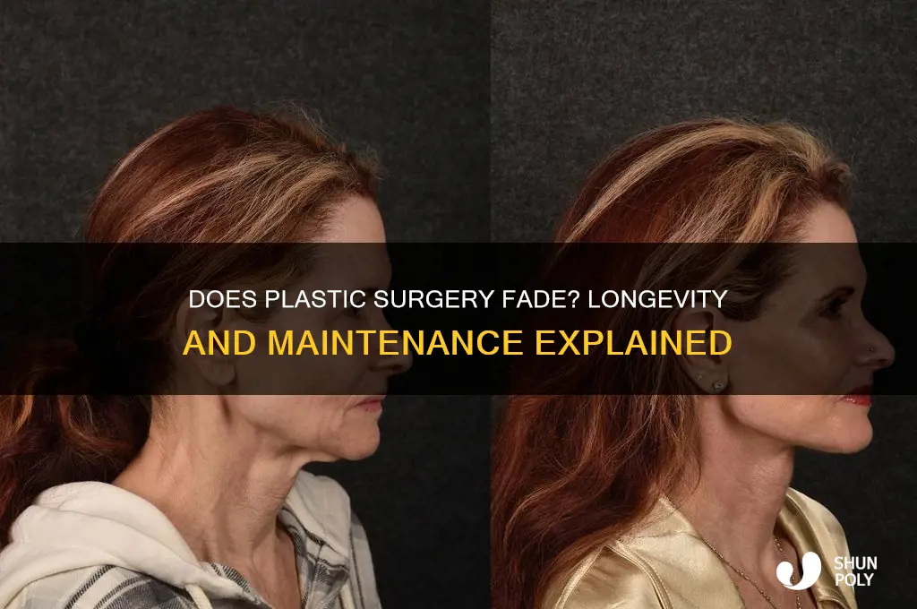 does plastic surgery wear off