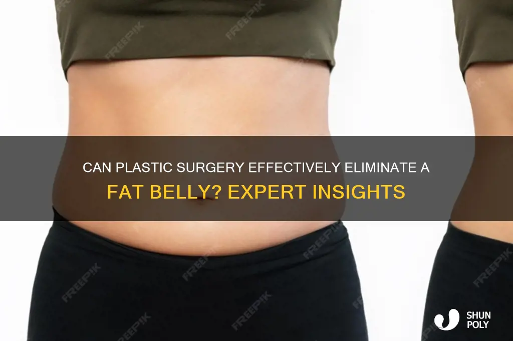 does plastic surgery work for a fat belly