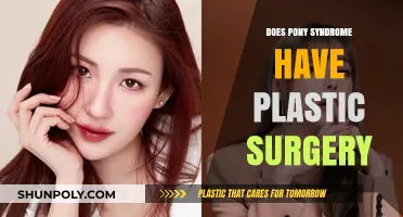 Did Pony Syndrome Undergo Plastic Surgery? Unraveling the Truth