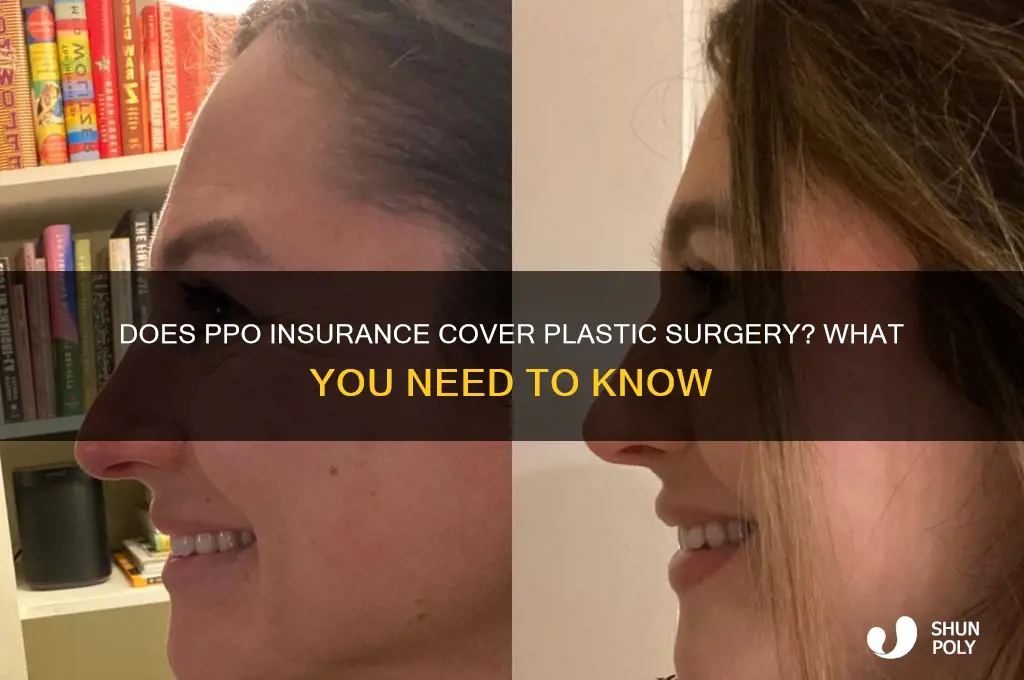 does ppo insurance cover plastic surgery