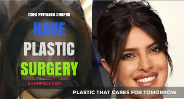Priyanka Chopra's Transformation: Plastic Surgery Rumors Explored
