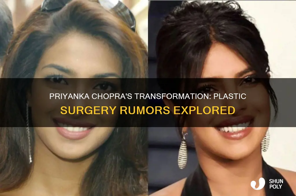does priyanka chopra have plastic surgery
