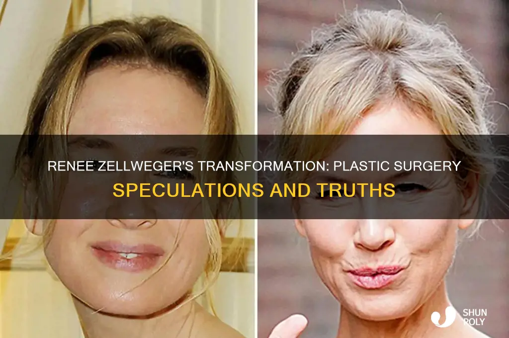 does renee zellweger have plastic surgery