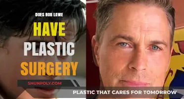 Rob Lowe's Ageless Appearance: Plastic Surgery Rumors Explored