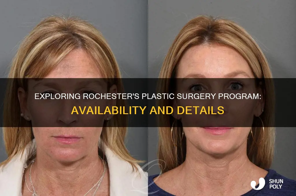 does rochester offer a plastic surgery pr9gram