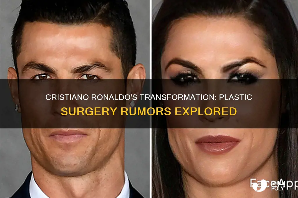 does ronaldo get plastic surgery