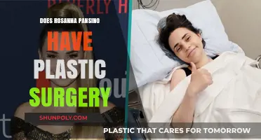 Rosanna Pansino Plastic Surgery: Fact-Checking the Rumors and Speculations