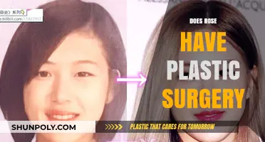 Rose's Transformation: Unveiling the Truth About Plastic Surgery Speculations