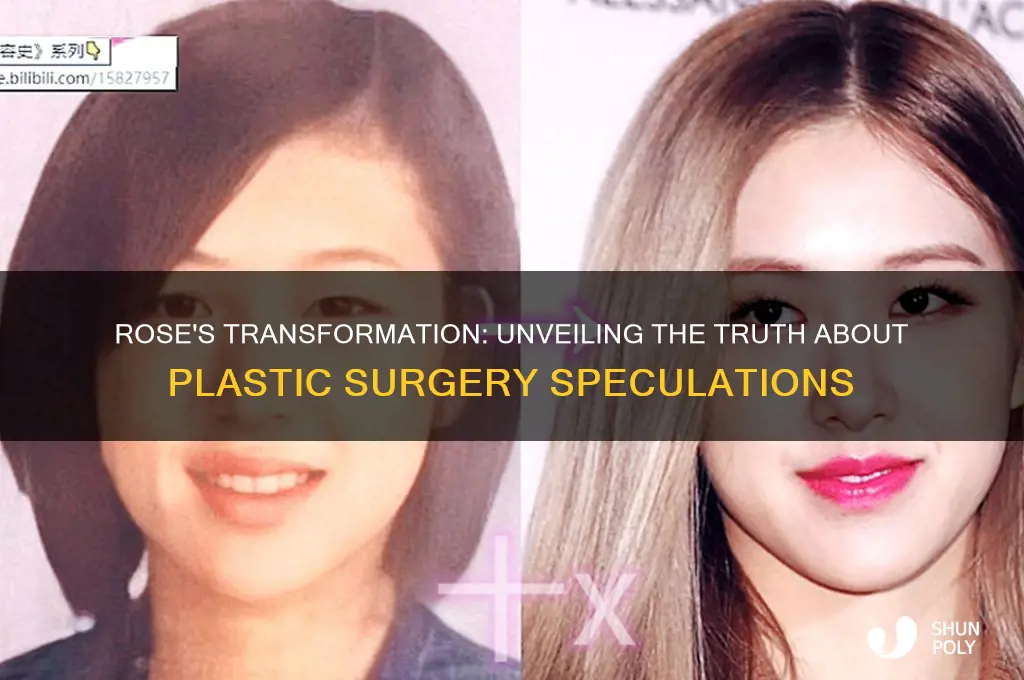 does rose have plastic surgery
