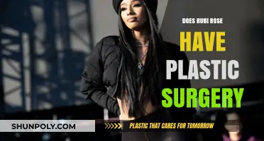 Rubi Rose Plastic Surgery: Fact-Checking the Rumors and Speculations