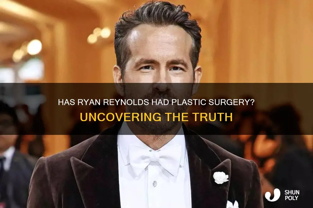 does ryan reynolds have plastic surgery