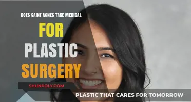 Does Saint Agnes Cover Medical Costs for Plastic Surgery Procedures?
