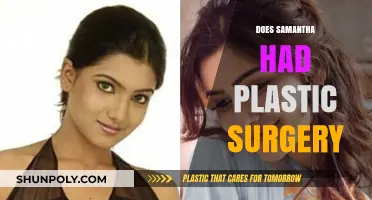 Did Samantha Undergo Plastic Surgery? Unraveling the Truth Behind Her Look