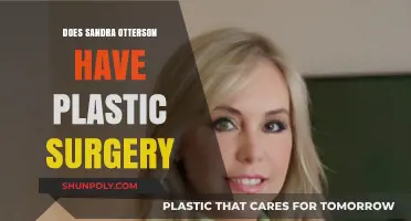 Sandra Otterson's Plastic Surgery: Fact or Fiction? Unveiling the Truth