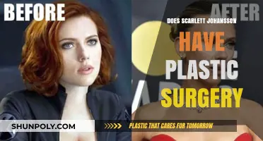 Scarlett Johansson's Transformation: Plastic Surgery Rumors Explored