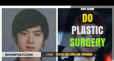 Sehun's Transformation: Uncovering Plastic Surgery Speculations and Truths