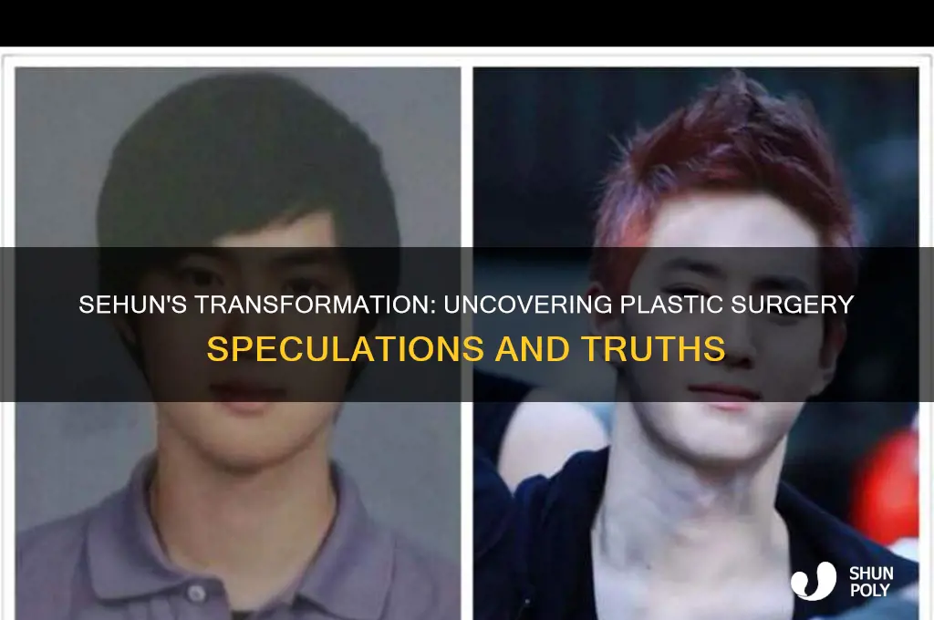 does sehun do plastic surgery