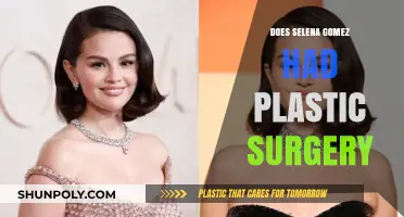 Selena Gomez Plastic Surgery Rumors: Fact or Fiction?