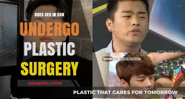 SEO In Guk Plastic Surgery Rumors: Fact or Fiction?