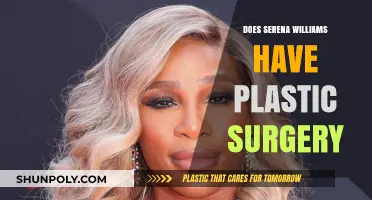 Serena Williams Plastic Surgery: Fact-Checking the Rumors and Speculations