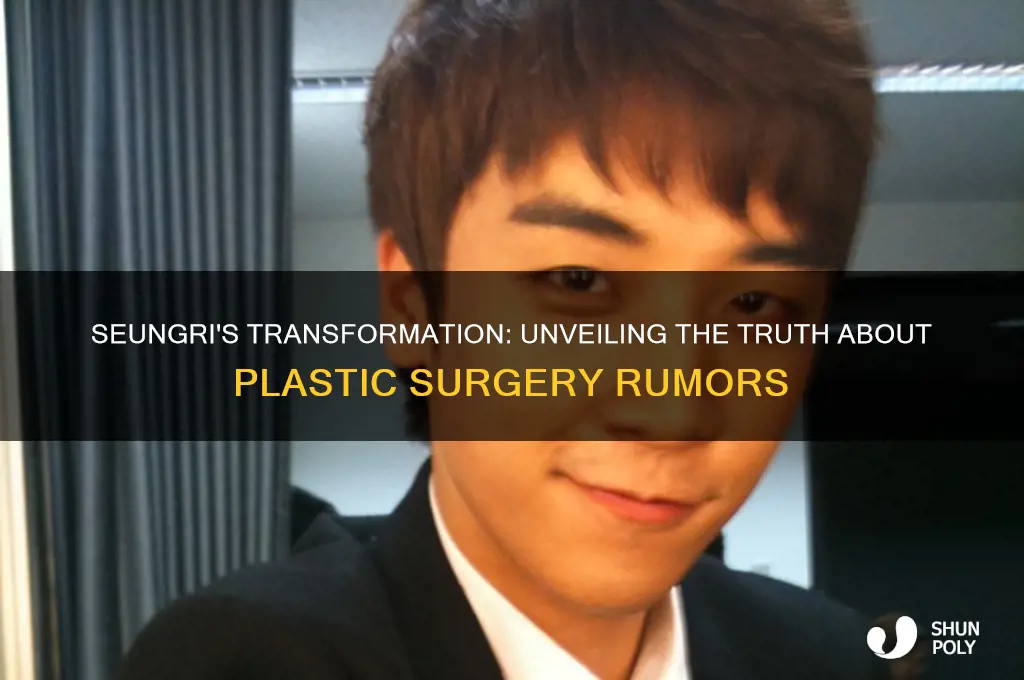 does seungri have plastic surgery