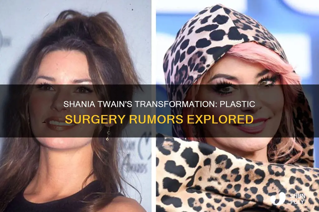 does shania twain have plastic surgery