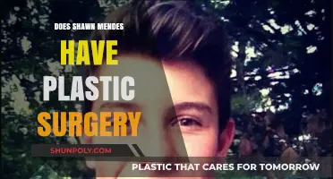 Shawn Mendes Plastic Surgery Rumors: Fact or Fiction?