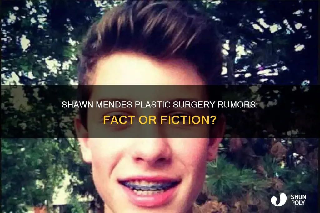 does shawn mendes have plastic surgery