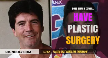 Simon Cowell's Transformation: Plastic Surgery Speculations and Truths