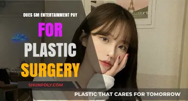 Does SM Entertainment Cover Plastic Surgery Costs for Idols?