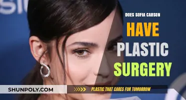 Sofia Carson's Transformation: Plastic Surgery Rumors and Facts Revealed
